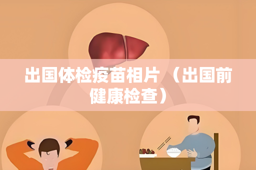 出国体检疫苗相片 （出国前健康检查）