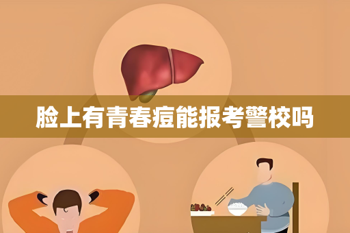 脸上有青春痘能报考警校吗
