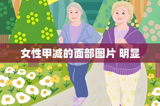 女性甲减的面部图片 明显