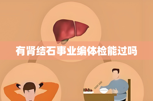有肾结石事业编体检能过吗