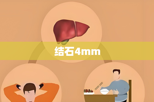 结石4mm