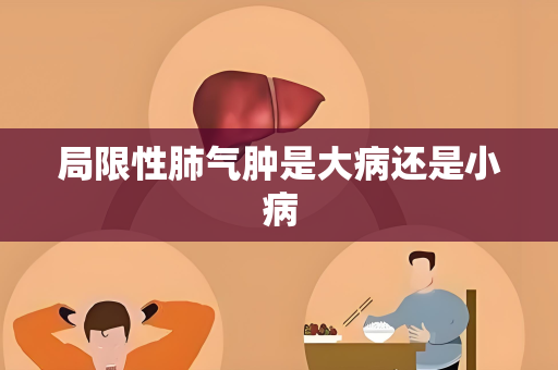 局限性肺气肿是大病还是小病