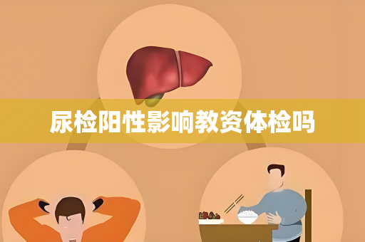 尿检阳性影响教资体检吗