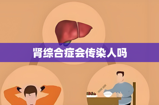 肾综合症会传染人吗